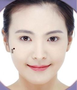 tahi lalat di tulang pipi